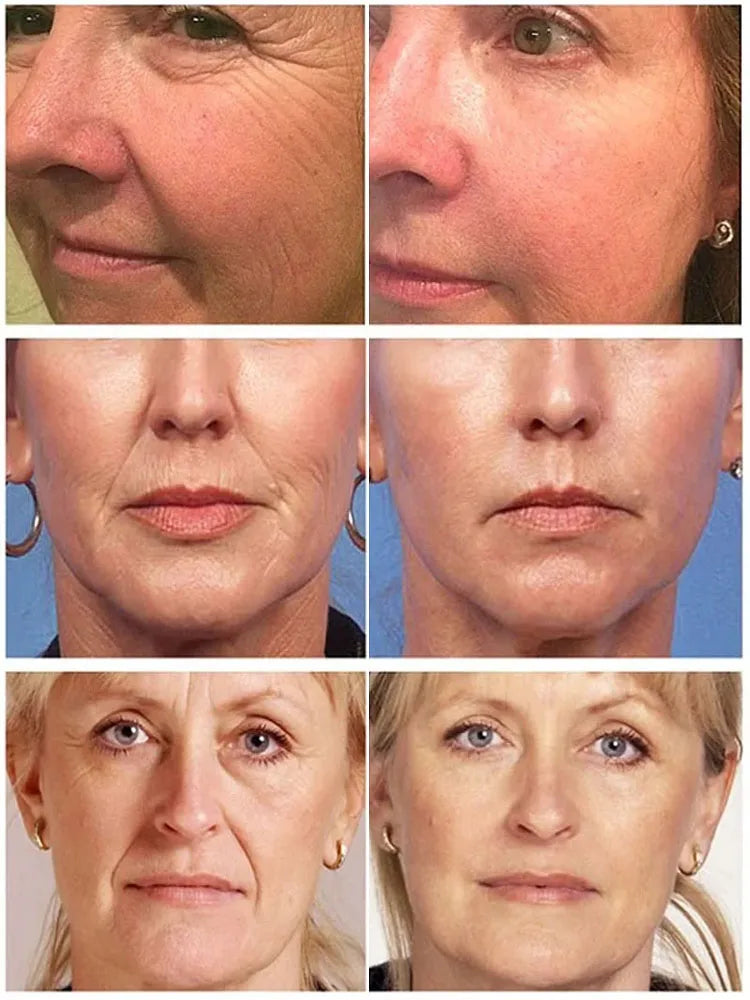 Collagen Face Serum Cream Set